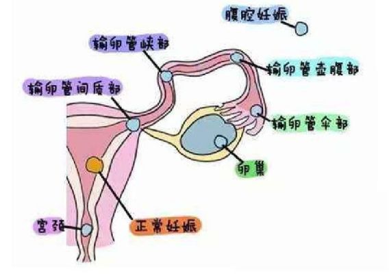 输卵复通信（输卵管复通有什么风险）